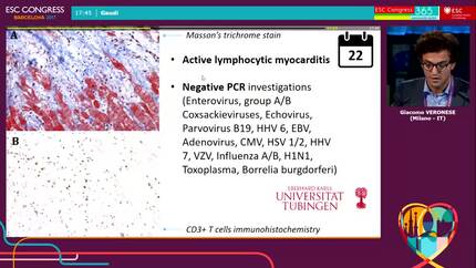 Not every fulminant lymphocytic myocarditis fully recovers