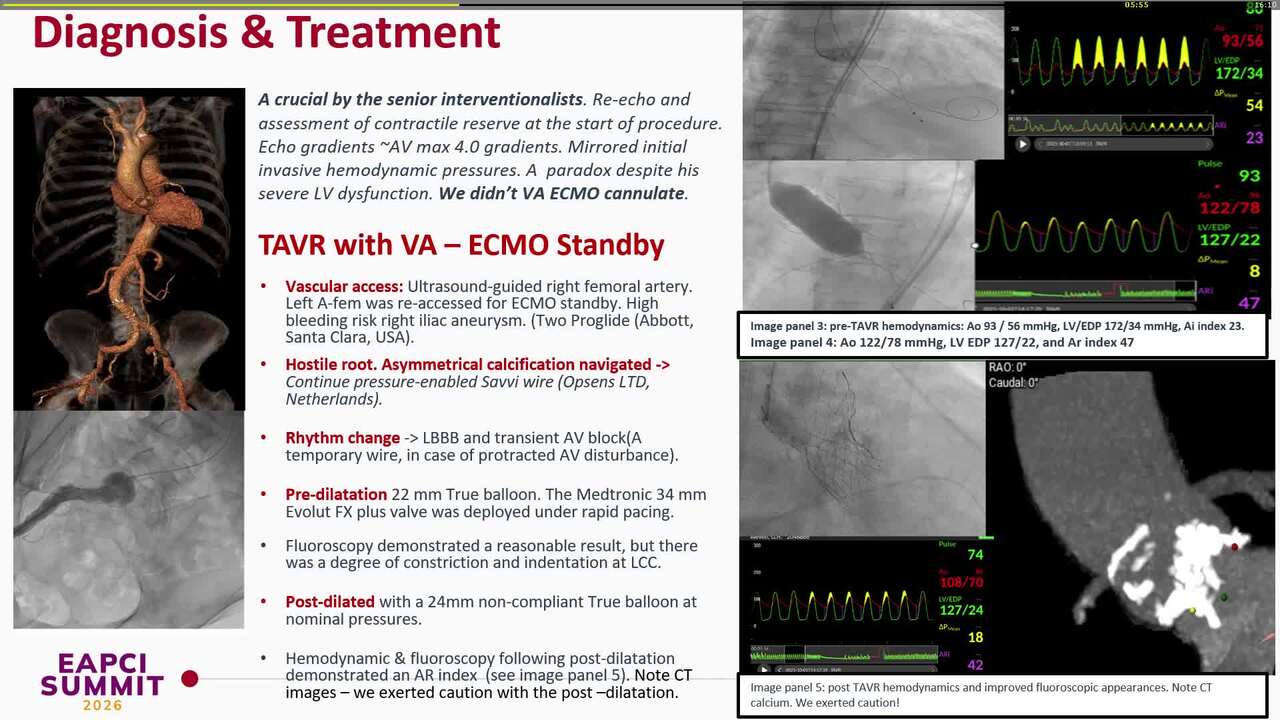To ECMO or not to ECMO