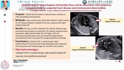 Determinants of fetal echogenic intracardiac focus and its association with pregnancy outcomes: links to congenital heart disease and chromosomal abnormalities