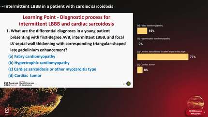 Intermittent LBBB in a patient with cardiac sarcoidosis