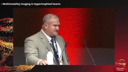 Multimodality imaging in cardiomyopathies