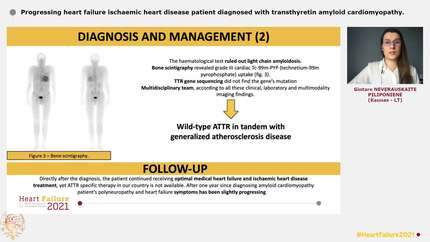 Progressing heart failure ischaemic heart disease patient diagnosed with transthyretin amyloid cardiomyopathy.