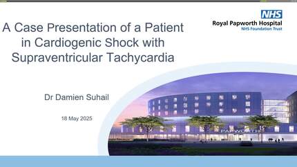 When the rhythm is of the essence