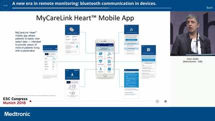 A new era in remote monitoring: bluetooth communication in devices.