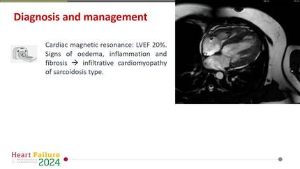 Heart failure and conduction abnormalities in a young patient: a case report of cardiac sarcoidosis.