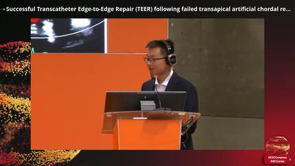 Successful Transcatheter Edge-to-Edge Repair (TEER) following failed transapical artificial chordal repair for primary mitral regurgitation