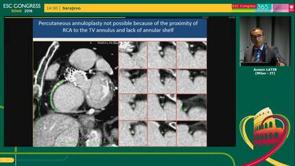 Presentation thumbnail