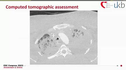 Acute cardiac care (1)