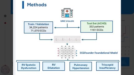 ECG-based artificial intelligence for risk stratification and outcome prediction after shunt closure in congenital heart disease