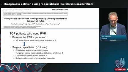 State-of-the-art management of ventricular arrhythmia in ACHD patients
