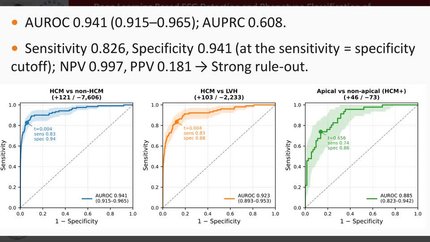 Deep learning–based ECG detection and phenotype classification of hypertrophic cardiomyopathy