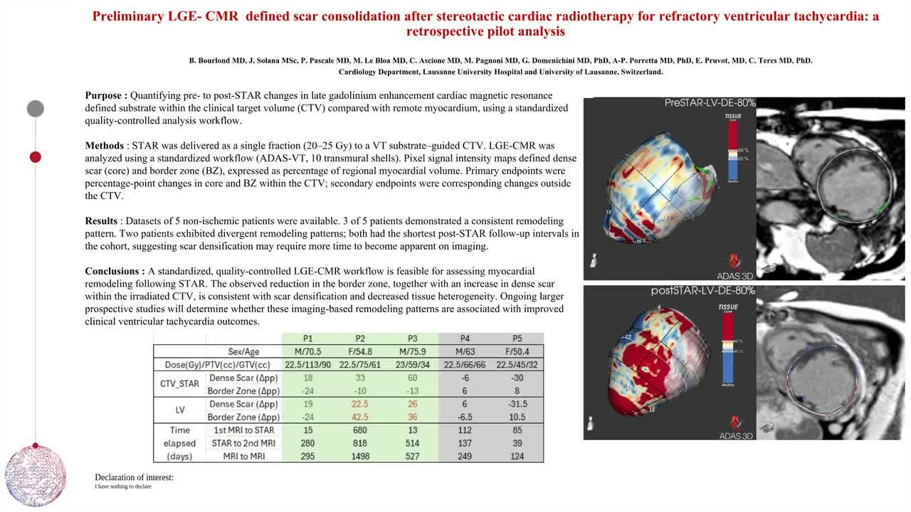 Preliminary LGE- CMR  defined scar consolidation after stereotactic cardiac radiotherapy for refractory ventricular tachycardia: a retrospective pilot analysis