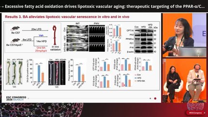 Vascular ageing and atherosclerosis