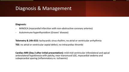Graves' disease presenting with myocarditis: a rare cardiac manifestation