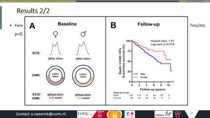 Normalization of QRS duration to left ventricular dimension improves patient selection for cardiac resynchronization therapy