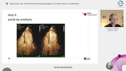 Presentation thumbnail
