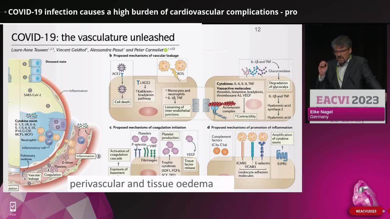 COVID-19 infection causes a high burden of cardiovascular complications - pro