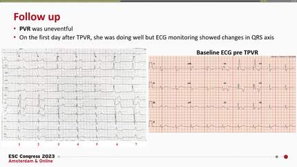Presentation thumbnail