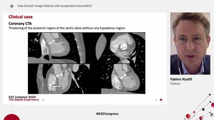 How Should I Image Patients with Suspected Endocarditis?