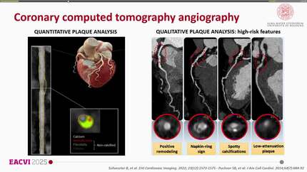Evolving roles of CT and PET in the management of cardiovascular disease