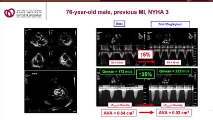Presentation thumbnail