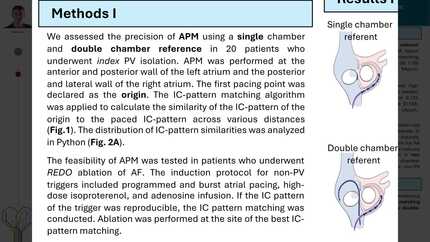 Atrial pace mapping with automatic intracardiac pattern matching for non-pulmonary vein trigger ablation: accuracy and feasibility