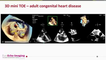 Presentation thumbnail