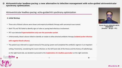 Atrioventricular leadless pacing: a new alternative to infection management with echo-guided atrioventricular synchrony optimization.