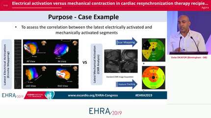 Electrical activation versus mechanical contraction in cardiac resynchronization therapy recipients:comparison between electroanatomical mapping and feature-tracking cardiovascular magnetic resonance