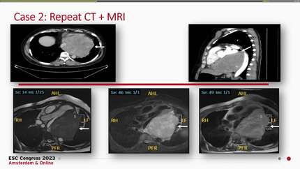 Presentation thumbnail