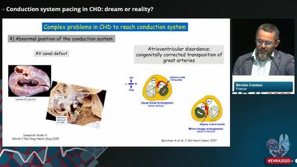 Conduction system pacing in CHD: dream or reality?