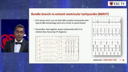 The ESC Grand Quiz Spectacular