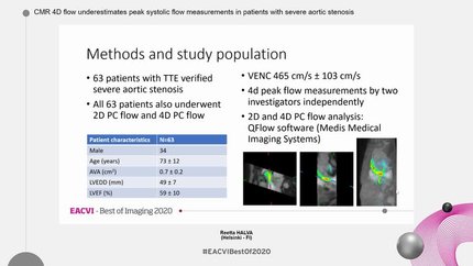 CMR 4D flow underestimates peak systolic flow measurements in patients with severe aortic stenosis