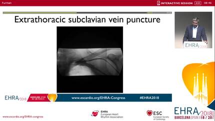 Techniques to facilitate venous access