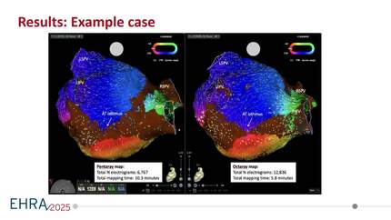 Comparison of high-density mapping of regular atrial tachyarrhythmia between an octaspline and a pentaspline multi-electrode catheter:  a randomized cross-over trial.