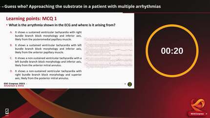 Guess who? Approaching the substrate in a patient with multiple arrhythmias