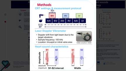 Non-contact laser Doppler vibrometry for measurement of heart sounds in patients undergoing cardiac resynchronization therapy