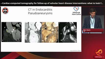 Cutting-edge computed tomographic assessment of valvular heart disease