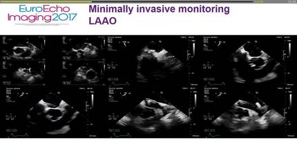 Presentation thumbnail