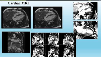 Presentation thumbnail