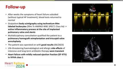 Presentation thumbnail