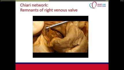 Presentation thumbnail