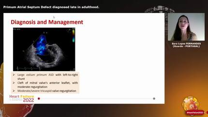 Primum Atrial Septum Defect diagnosed late in adulthood.