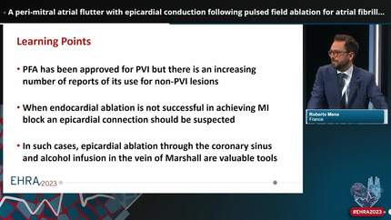 A peri-mitral atrial flutter with epicardial conduction following pulsed field ablation for atrial fibrillation
