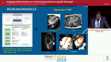 Imaging inflammation or measuring markers  to guide therapy?