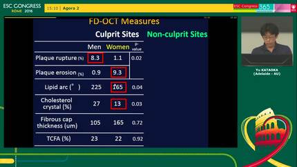 Gender differences in non-culprit coronary plaque microstructures on frequency-domain optical coherence tomography in stable coronary artery disease