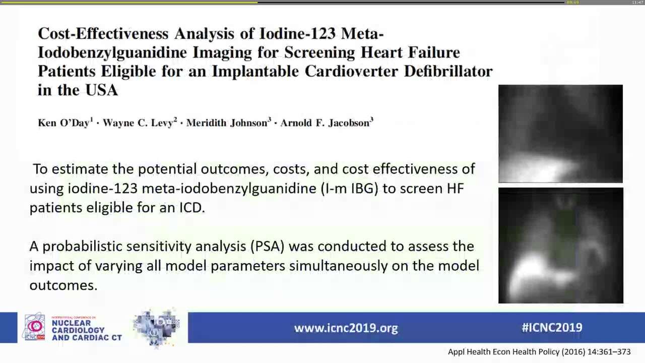 Management of arrhythmias