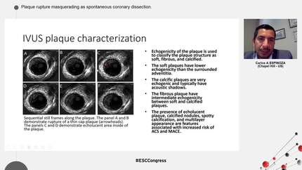 Presentation thumbnail
