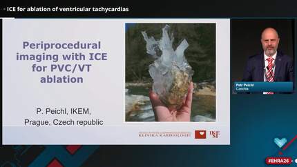 An EHRA and EAPCI scientific statement on the role of intracardiac echocardiography during invasive electrophysiological procedures