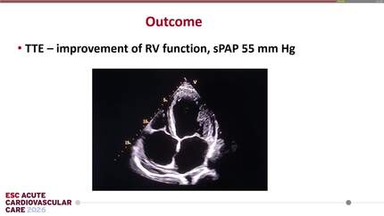 Presentation thumbnail